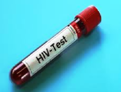 INCHS pede aos habitantes que façam teste de diagnóstico do VIH